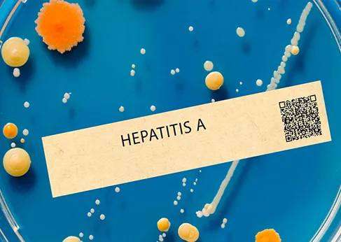 Standards for the control Hepatitis A